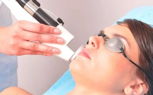 The effect of laser equipment on facial skin
