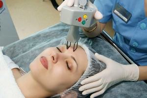 Laser partial facial rejuvenation