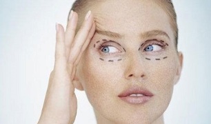 Type of eyelid plastic surgery to rejuvenate the skin around the eyes